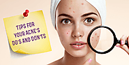 7 Dos and Don’ts of Acne