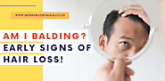 What Are The Early Signs of Hair Loss?