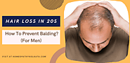 Hair Loss in 20s: How To Prevent Balding? (For Men)