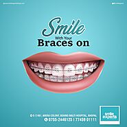 Braces specialist in Bhopal, with best orthodontist services at affordable prices smile expert Bhopal at E7 Arera Col...