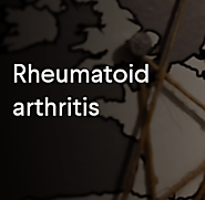 Rheumatoid arthritis Archives - Biofron