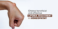Choose beneficial and effective lipoma treatment in Homeopathy