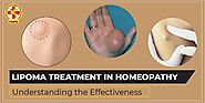 HiiMS: Lipoma Treatment in Homeopathy - Understanding the Effectiveness