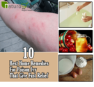 10 Effective and Best Home Remedies for Poison Ivy