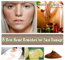 8 Best Home Remedies for Skin Damage to Improve Skin Health