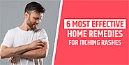 6 Home Remedies For Itching Rashes | Shuddhi Ayurveda