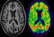 Neurology Imaging Test - How To Get Ready For It? (Healt Care-Neurological Center)