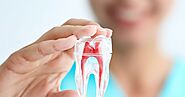 Is Root Canal Therapy Painful?