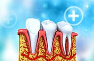 Know everything about Root Canal Treatment | by James Parker | Sep, 2021 | Medium