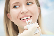 What are Veneers? - The Dental Bond Blog