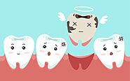How to Prepare for a Tooth Extraction - The Dental Bond Blog