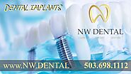 Dental Implants Clackamas Oregon Dentist | NW Dental | Implants Extractions Cosmetic Dentistry