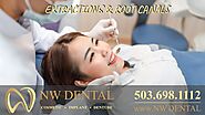 Clackamas Dentist Extractions & Root Canals Restorative Dentistry Dental Implants Crowns Dentures