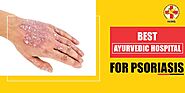 Best ayurvedic hospital for psoriasis: Step by step guide