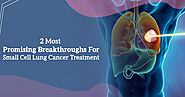 2 Most Promising Breakthroughs For Small Cell Lung Cancer Treatment