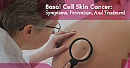 Basal Cell Skin Cancer: Symptoms, Prevention, And Treatment