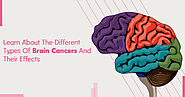 Learn About The Different Types Of Brain Cancers And Their Effects