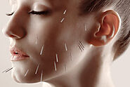 Acupuncture for Skin Diseases | Philadelphia Acupuncture Clinic