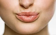 Lip flip treatment in Melbourne | The must have treatment in 2021