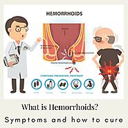 Treatment for Hemorrhoids - Philadelphia Homeopathic Clinic - Dr. Tsan