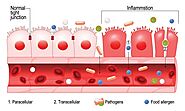 Treatment for Leaky Gut - Philadelphia Homeopathic Clinic - Dr. Tsan & Co