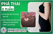 Phá thai 5 tuần có được không? Phương pháp nào an toàn?