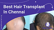 Best Hair Transplant Clinic in Chennai