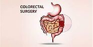 Morbidity and mortality following colorectal surgery in patients with end-stage renal failure: a population-based stu...