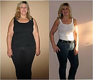 Gastric Balloon Toronto - Options Weight Loss Clinic
