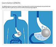 ORBERA Gastric Balloon | Bariatric Services | OHSU Burnaby