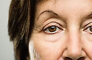 Ptosis Surgery (Drooping Eyelid Surgery) - Get A Permanent Eyelid Lift