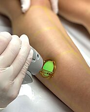 Laser Hair Removal Woodgrove Melton West | Laser Treatment Near Me - Result Laser Clinic