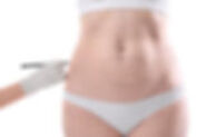Panniculectomy | Toronto | Canadian Plastic Surgery Centre