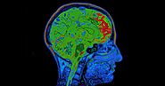 Brain Disease Modalities: A Short Guide on PET, PET-CT, and PET-MRI Scans