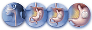 Weightloss Treatment Hyderabad | Gastric Balloon Surgery - Gastro Clinics