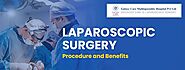 Importance of Laparoscopic Surgery: Procedure and Benefits - Galaxy Care