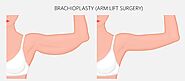 Arm Lift Surgery (Brachioplasty) in calgary– Cost, Pictures, Surgeon Info