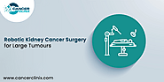 Things to Know About Kidney Cancer Surgery