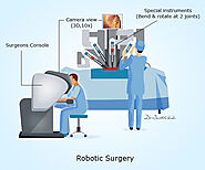 Robotic Surgery for Kidney Cancer