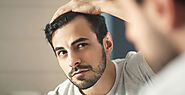 Hair Transplant: All You Need to Know!