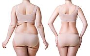 Liposuction Surgery- Get Rid Of Excess Fat & Shape Your Body Nicely & Perfectly