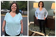 After obesity surgery, more patients returning for another - StAlbertToday.ca