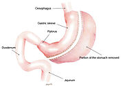 Website at https://weightlossjax.com/bariatric-surgery/gastric-sleeve/