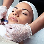 Why Are Professional Microneedling Pens Transforming Skincare?