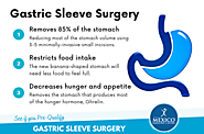 Gastric Sleeve Surgery in Tijuana, Mexico - Starting at $4,595