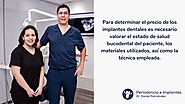 Precios de implantes dentales | Periodoncista