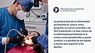 Enfermedad Periodontal y otras enfermedades sistémicas | Periodoncista