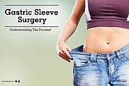 Gastric Sleeve Surgery - Understanding The Process! - By Dr. Tarun Mittal | Lybrate