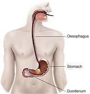 Gastric Balloon Surgery in Tijuana Mexico by Dr. Nunez