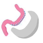 Sleeve gastrectomy - Wikipedia